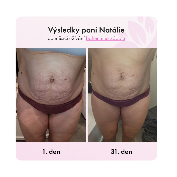 Bahenní zábal na střední celulitidu - Obrázek 3
