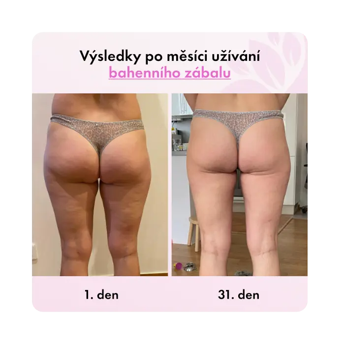 Bahenní zábal Guam FIR na břicho a pas - Obrázek 3