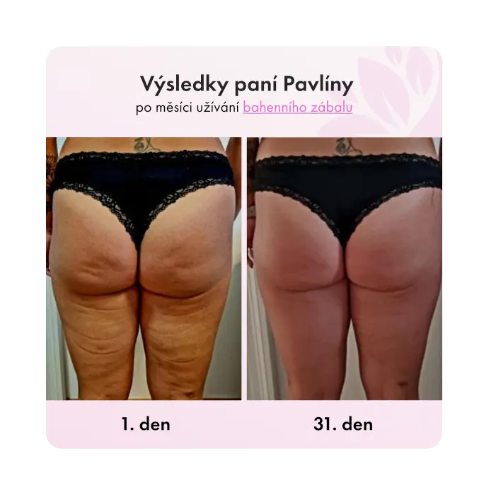 Bahenní zábal Guam proti těžké celulitidě - Obrázek 3